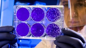 Organ yang Menyusun Sistem Ekskresi pada Hewan: Memahami Proses Pembuangan Limbah dalam Tubuh Hewan