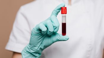 ترتبط فصيلة الدم بخطر الإصابة بسكتة دماغية قبل سن 60 عاما ، وفقا للدراسات
