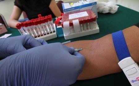 Dinkes: 88 Warga di Lhokseumawe Terinfeksi HIV, Rata-rata Penularannya karena Seks Bebas