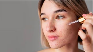 ホルモンと環境の影響を受けた顔の斑点メラズマ