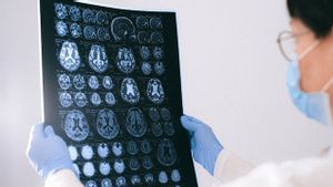 Bukan Bulat, Hasil Analisis Sebut Ini Bentuk Awal Otak Manusia