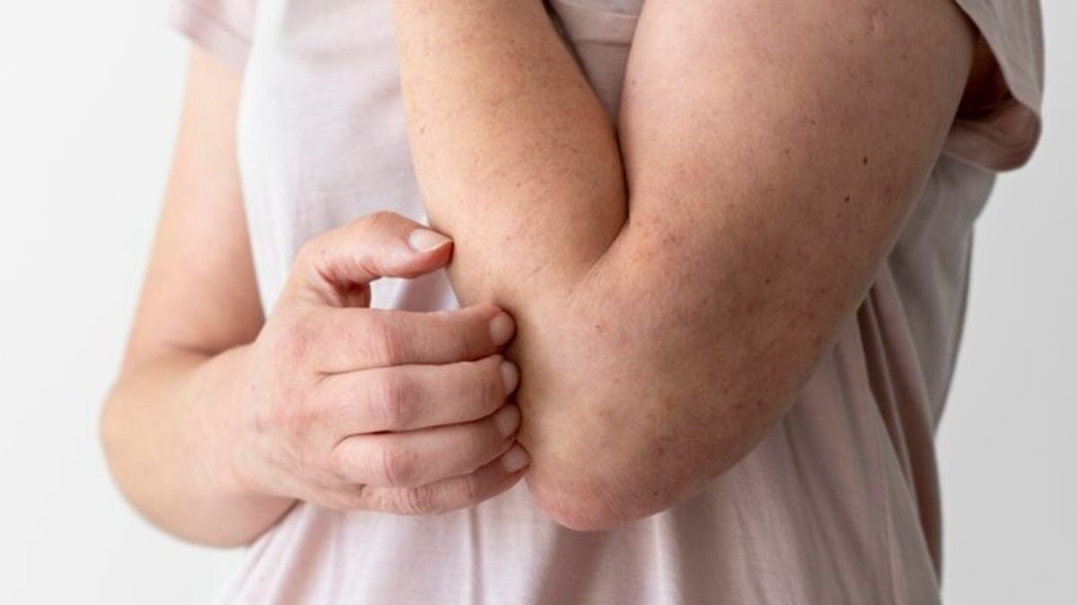 Why Do Diabetics Often Feel Itchy? This Is The Cause And Solution