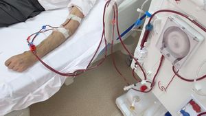 Apakah Cuci Darah Membatalkan Puasa? Ini Penjelasan Buya Yahya 