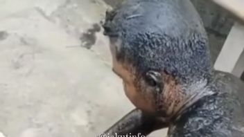 タンゲランアラミでの乱闘の犠牲者は、硬水をはねかけられた結果、顔に火傷を負った