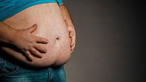 Menkes Kata Menkes Bisa Picu Kematian Dini, Apa Sebenarnya Visceral Fat?