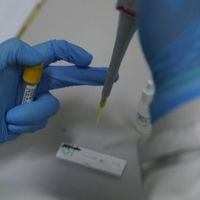 Update COVID-19 per 30 Mei: Kasus Baru 541, Kasus Aktif 12.656