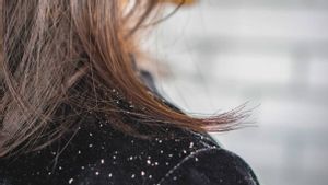 Ketombe Bukan Sekadar Serpihan, Benarkah Bisa Bikin Rambut Rontok?