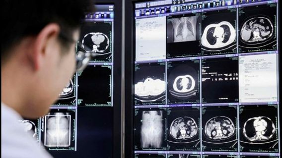 PANDA: L'innovation d'Alibaba pour la détection du cancer reconnue par le monde