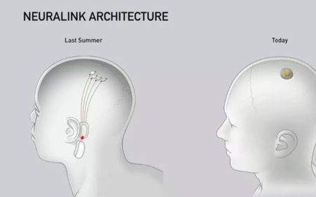 Neuralink milik Elon Musk akan Segera Tanamkan Implan pada Otak Manusia, Lampu Hijau dari FDA!