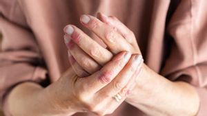 8 Tips Kecantikan bagi Penderita Psoriasis, Percaya Diri Jadi Kunci Penting