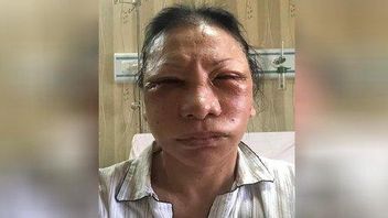 de Ratna Sarumpaet Rugikan Kubu Prabowo Subianto dans l’histoire aujourd’hui, 27 octobre 2018