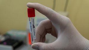 Rumah Sakit di Prancis Bersiap Antisipasi Lonjakan Kasus Infeksi Varian Baru Virus Corona
