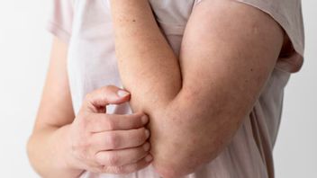 なぜかゆみは体のいくつかの部分を動かすことができますか?これは医学的説明です