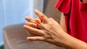 Banyak Orang Keliru soal Asam Urat, Ini Fakta Sebenarnya