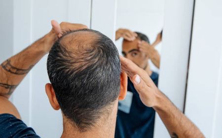 3 Bahan Ayurveda Ini Bisa Bantu Tumbuhkan Rambut di Area yang Botak, Penasaran?