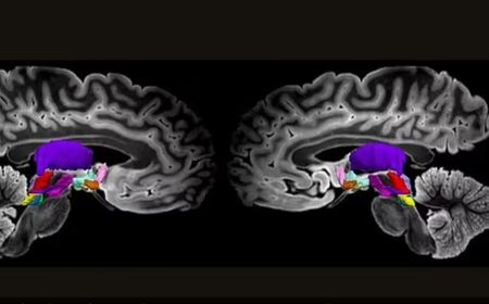 Temuan Baru: Identifikasi Jaringan Saraf Kunci dalam Otak yang Berperan dalam Kesadaran