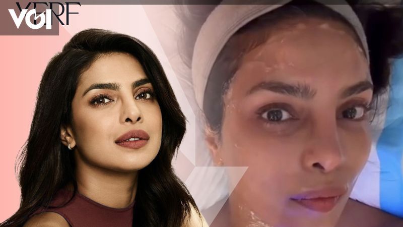 The Power of XERF: More than a trend, its Priyanka Chopras treatment choice