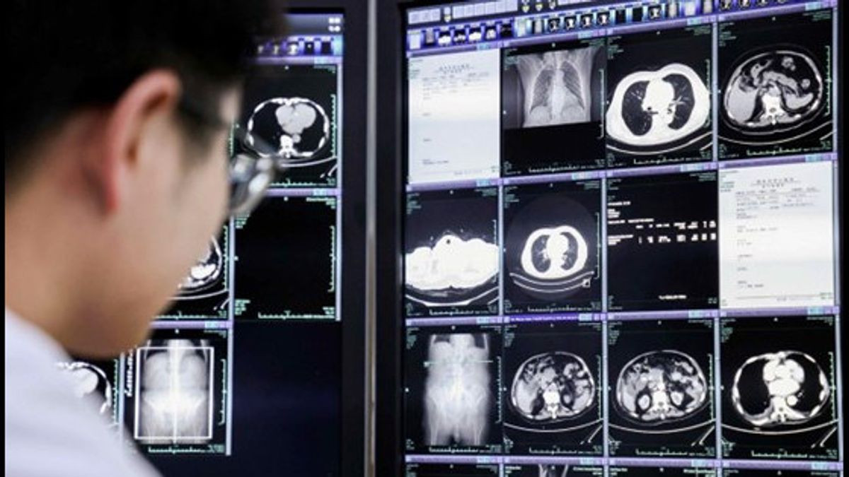 PANDA: AI Innovation For Cancer Detection From Alibaba Gets International Recognition