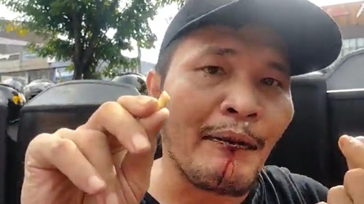 血嘴捂住被打掉的牙齿，Nicho Silalahi：我成为警察殴打的受害者
