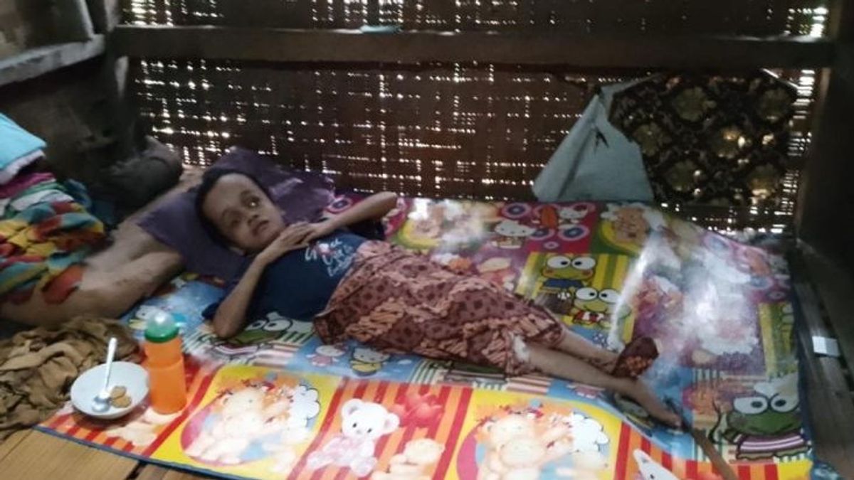 Girl With Hydrocephalus In Lebak, Banten Needs Help For Treatment