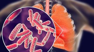 I'm Well! TB Cases In Jakarta Drop, This Is The DKI Provincial Government's Strategy