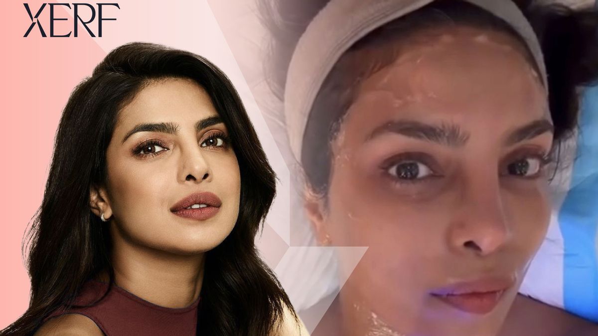 The Power of XERF: Plus qu'une tendance, c'est le choix du traitement de Priyanka Chopra