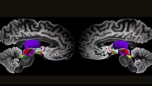Temuan Baru: Identifikasi Jaringan Saraf Kunci dalam Otak yang Berperan dalam Kesadaran