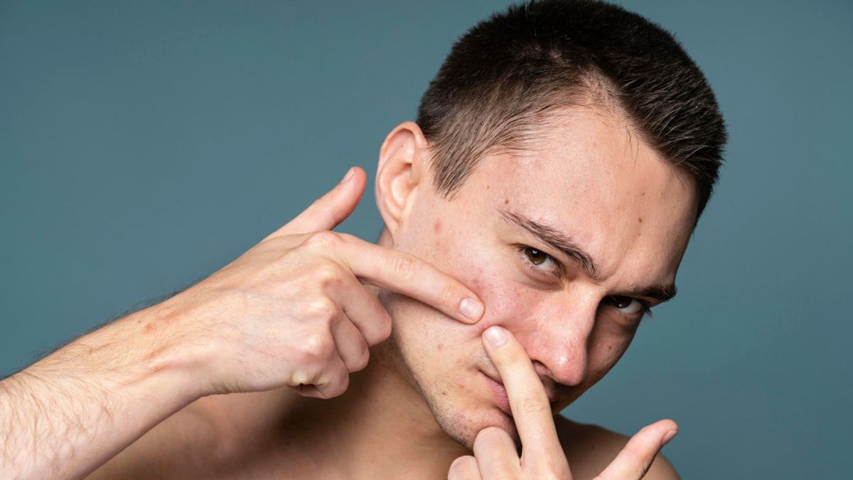 Tumbuh Jerawat di Pipi karena Makan Apa? Ini Penyebab dan Rekomendasi Dermatolog