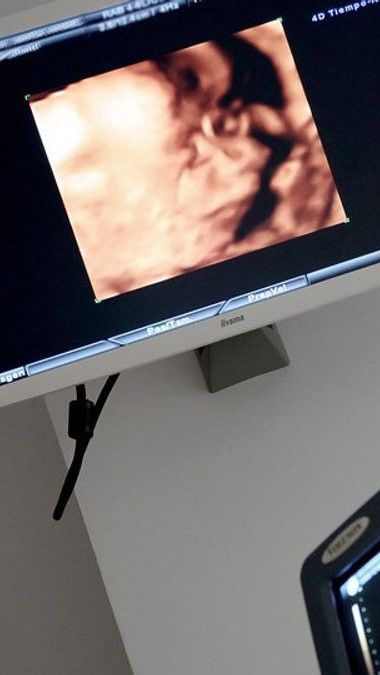 Tips For Clear 4D Ultrasound Results, Do This