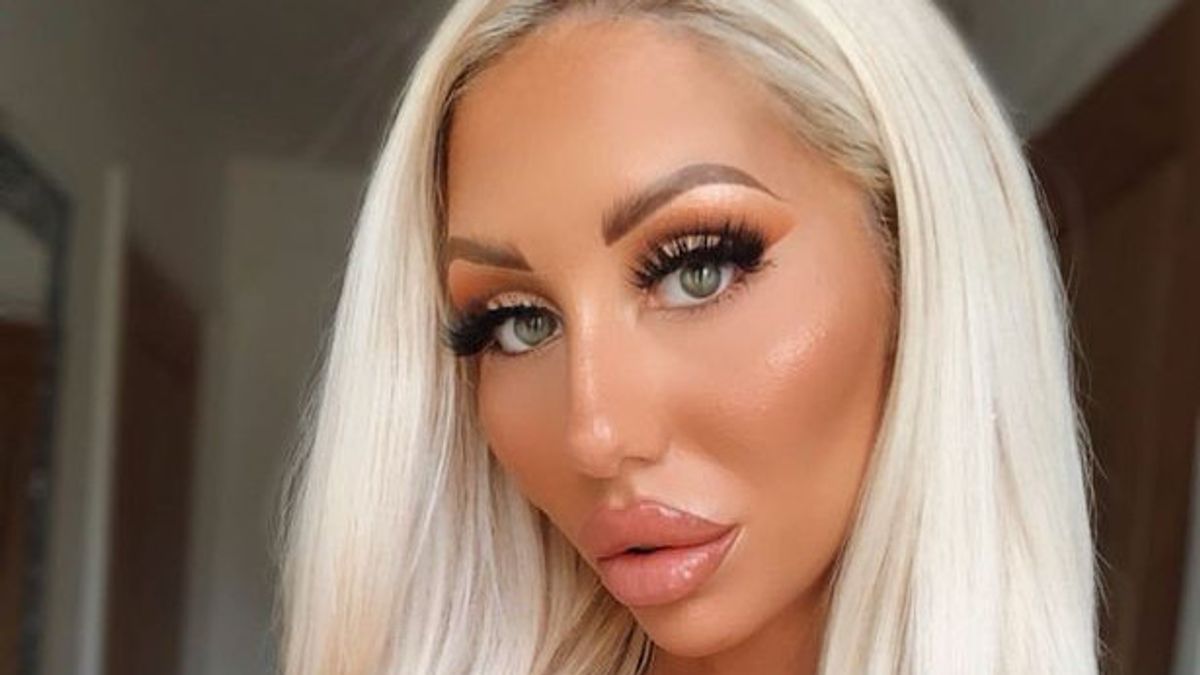 Wife Wants To Be Like Barbie, Husband Pays Rp. 318 Million For Plastic Surgery