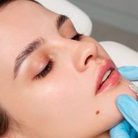 Tren Botox Bibir, Dokter Kecantikan Peringatkan Risikonya