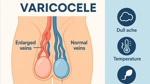 Cara Mencegah Varikokel, Simak Ulasannya di Sini!