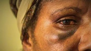 Kekerasan Terhadap Perempuan di Papua Tertinggi di Indonesia, Harus Segera Diatasi