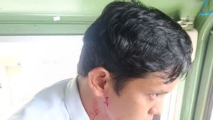 Kaca Lokomotif Pecah Asisten Masinis Luka, KAI Sumut Geram Buru Pelempar Batu ke Kereta Sawit Asahan