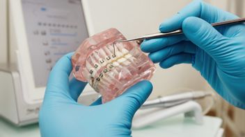 Mengetahui Berapa Harga Pasang Behel dari yang Murah sampai Premium