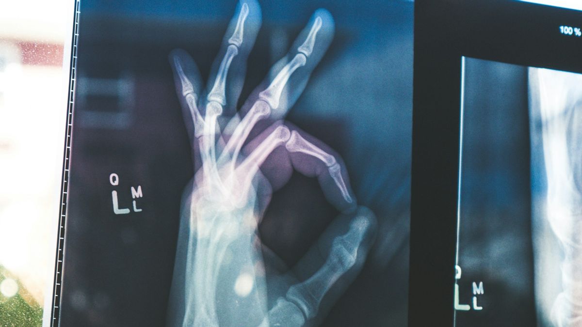 Klinik Pengobatan Radang Sendi Arthritis Terbaik