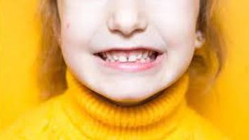 Growing Up Rapidly And Healthy, Here Are 7 Ways To Prevent Tonggos Teeth In Children From An Early Age