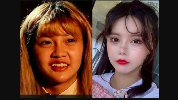 Menyesal Usai Operasi Hidung, Influencer China Ini Akui Sulit Bernapas