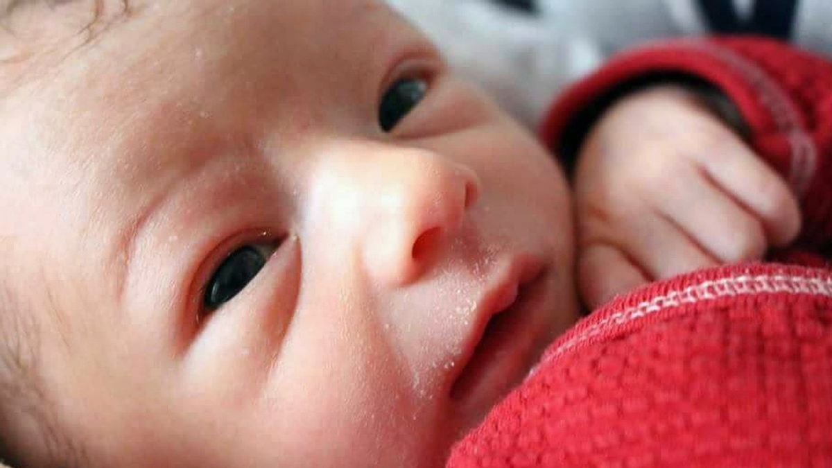 7 Cara Merawat Kulit Bayi yang Mengelupas, Orang Tua Wajib Tahu! 