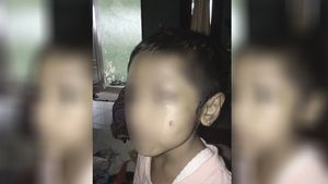 Ibu Tiri di Ciracas yang Aniaya Bocah 5 Tahun Gegara Makanan Bakal Ditindak 