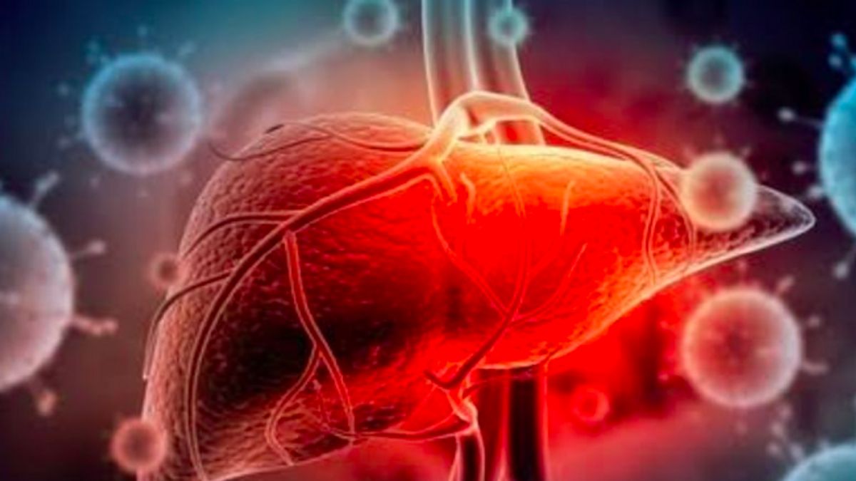 كن على دراية بالتهاب الكبد ، وهو مرض بدون أعراض يمكن أن يكون قاتلا