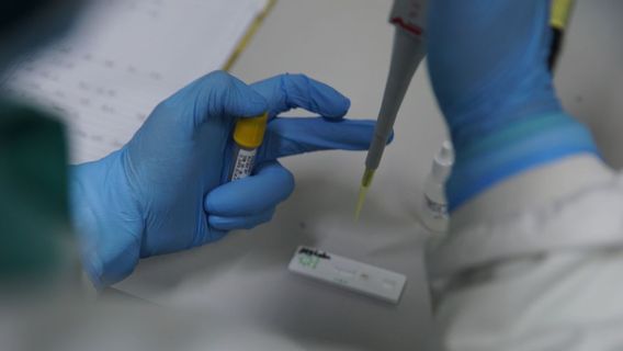 Riau Islands Governor Requests 147 Thousand Antigen Swab Test Kits For Assistance To The Central Government