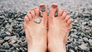Jamur Kuku Kaki seperti Apa? Kenali Gejala dan Cara Menghilangkannya