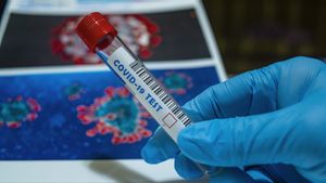 Perbedaan Pandemi COVID-19 dengan Flu Burung
