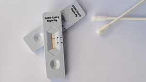 Pakar Epidemiolog Minta Pemerintah Kaji Ulang Harga Rapid Test COVID-19 Antigen