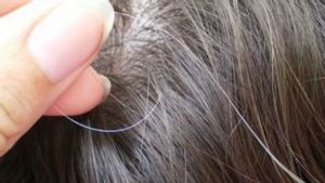 Merawat Rambut Beruban di Usia Muda dengan Cara Mudah