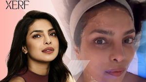 The Power of XERF: Not Just a Trend, This is Priyanka Chopra's Treatment Choice