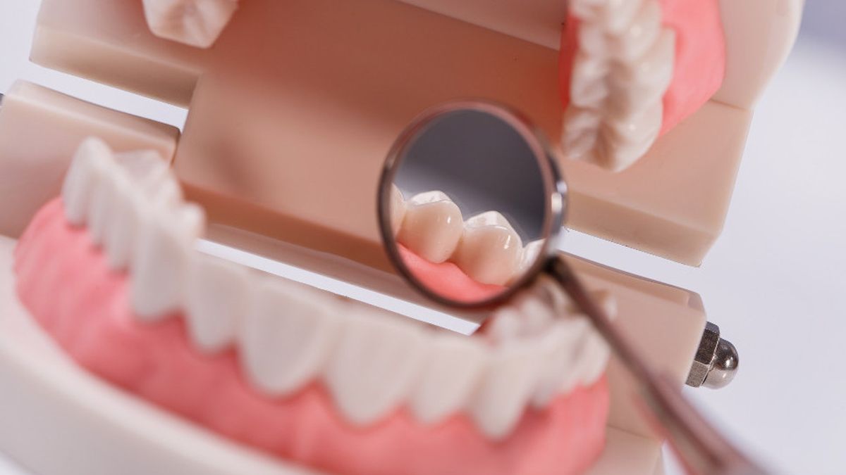 La caries dentaire peut-elle disparaître? guérir avec le traitement suivant