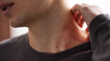 احترس! هذه هي سمة عض التنغاو التي تحتاج إلى معرفتها