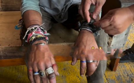 Petugas Potong Cincin di 10 Jari Pria ODGJ yang Membengkak